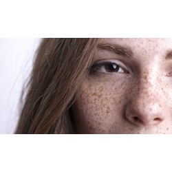 Tratamientos Faciales y para Hiperpigmentaciones