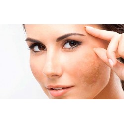 Tratamientos Faciales y para Hiperpigmentaciones